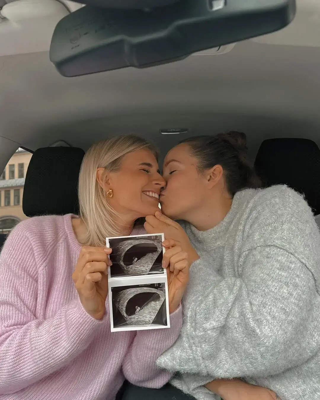 ecografia de beb&eacute; de duas mulheres com beijo carinhoso